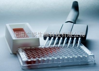 小鼠碱性成纤维细胞生长因子4(bFGF-4)进口ELISA试剂盒 精准检测的专业之选